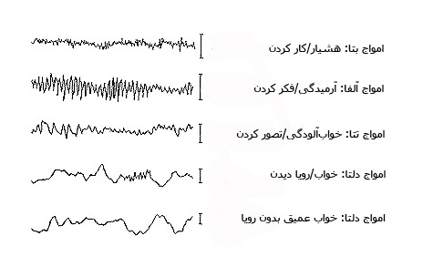 brainwaves۲