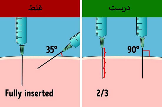 آموزش تصویری تزریق عضلانی به خود و دیگران