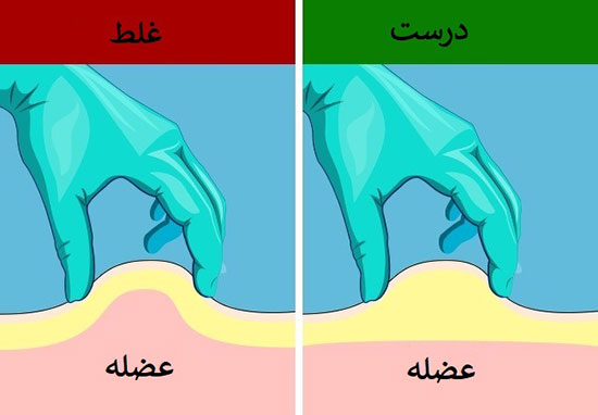 آموزش تصویری تزریق عضلانی به خود و دیگران