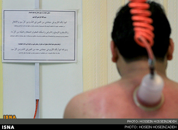 حجامت و زالودرمانی بیمه نیستند/ پرداخت از جیب ۱۰۰ درصدی مردم در حوزه طب ایرانی
