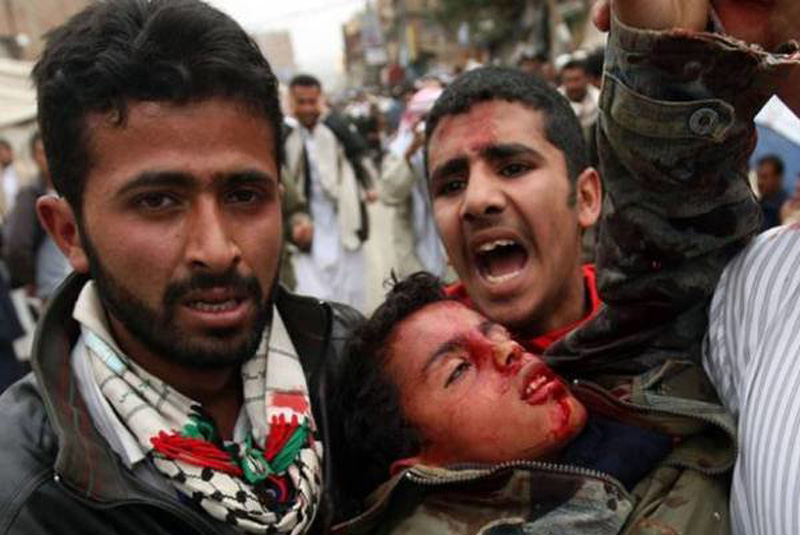 قتل‌عام مردم مظلوم یمن از روی دلسوزی!