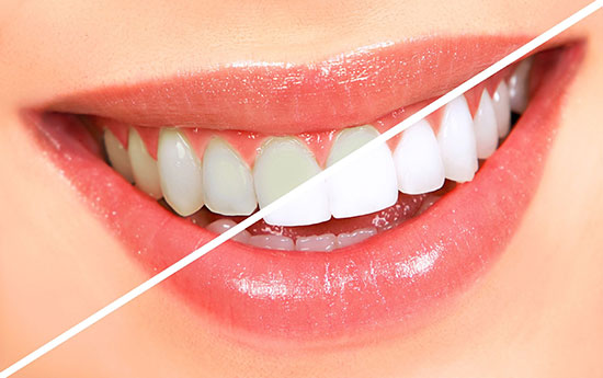 با بهترین راهکارهای زیبایی دندان آشنا شوید
