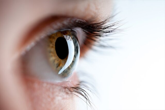 روش‌های تشخیص “بدرنگ بینی” / بیمارانی که دنیا را خاکستری می‌بینند