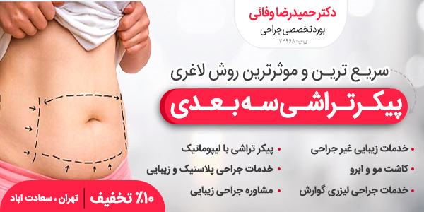 معجزه پیکر تراشی سه بعدی