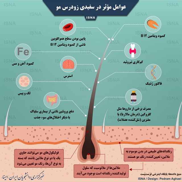 اینفوگرافی / عوامل مؤثر در سفیدی زودرس مو