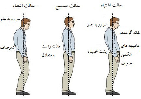 نحوه راه رفتن و خوابیدن صحیح برای ورزشکاران+ تصویر