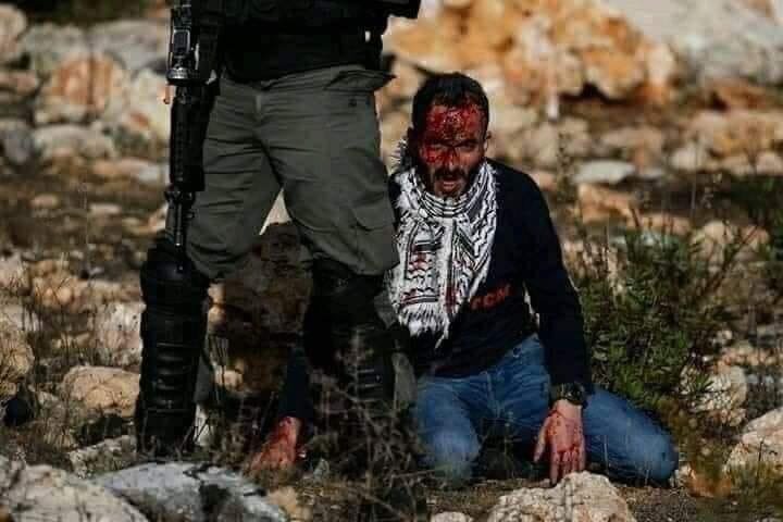 یک فلسطینی زخمی در رام‌الله به شهادت رسید