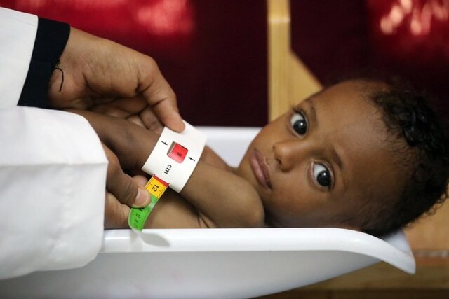 یونیسف: هر ۱۰ دقیقه یک کودک یمنی می‌میرد