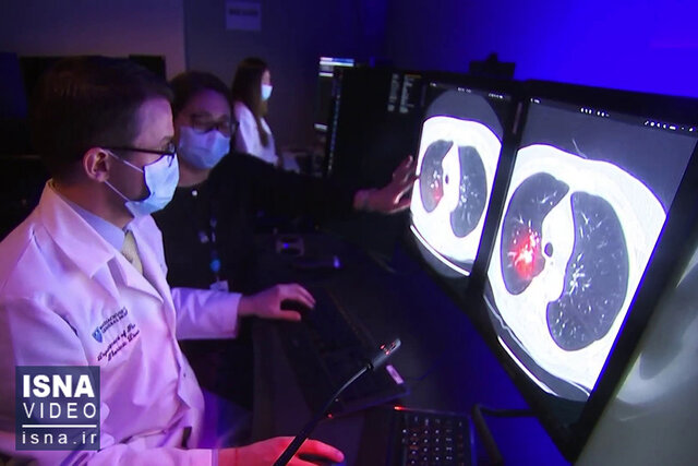 ویدیو/ تشخیص زودهنگام سرطان سینه با هوش مصنوعی